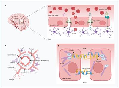 Immunotherapy revolutionizing brain metastatic cancer treatment: personalized strategies for transformative outcomes